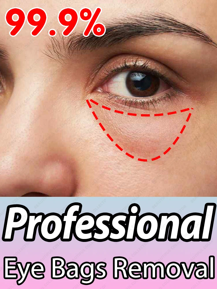 Quickly Eye Bags Removal Eyes Wrinkle Fine Line