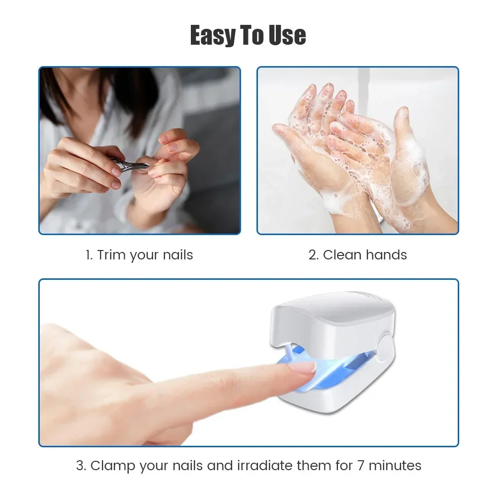 Eletric Nail Fungus Cleaning Laser Treatment Device Repair Toenail Fingernail Fungus Onychomycosis Remover Cure Therapy Machine