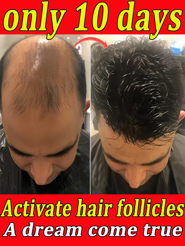 Say goodbye to baldness, hair growth essential oil will make your hair grow so long that the comb will burst