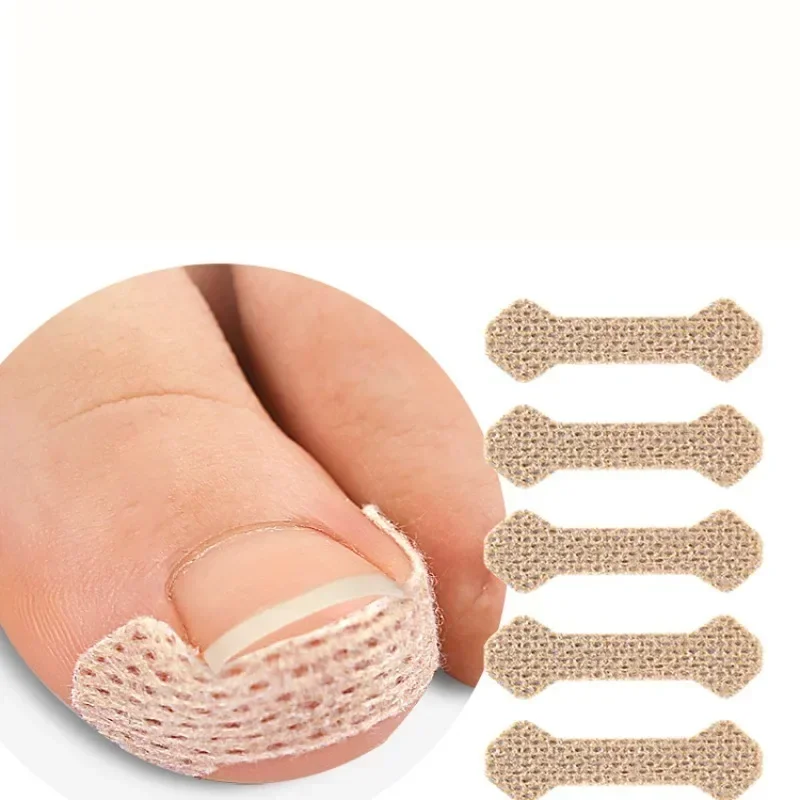 40/100pcs Nail Correction Stickers Ingrown Toenail Corrector Patches Treatment Recover Corrector Pedicure Care Tool