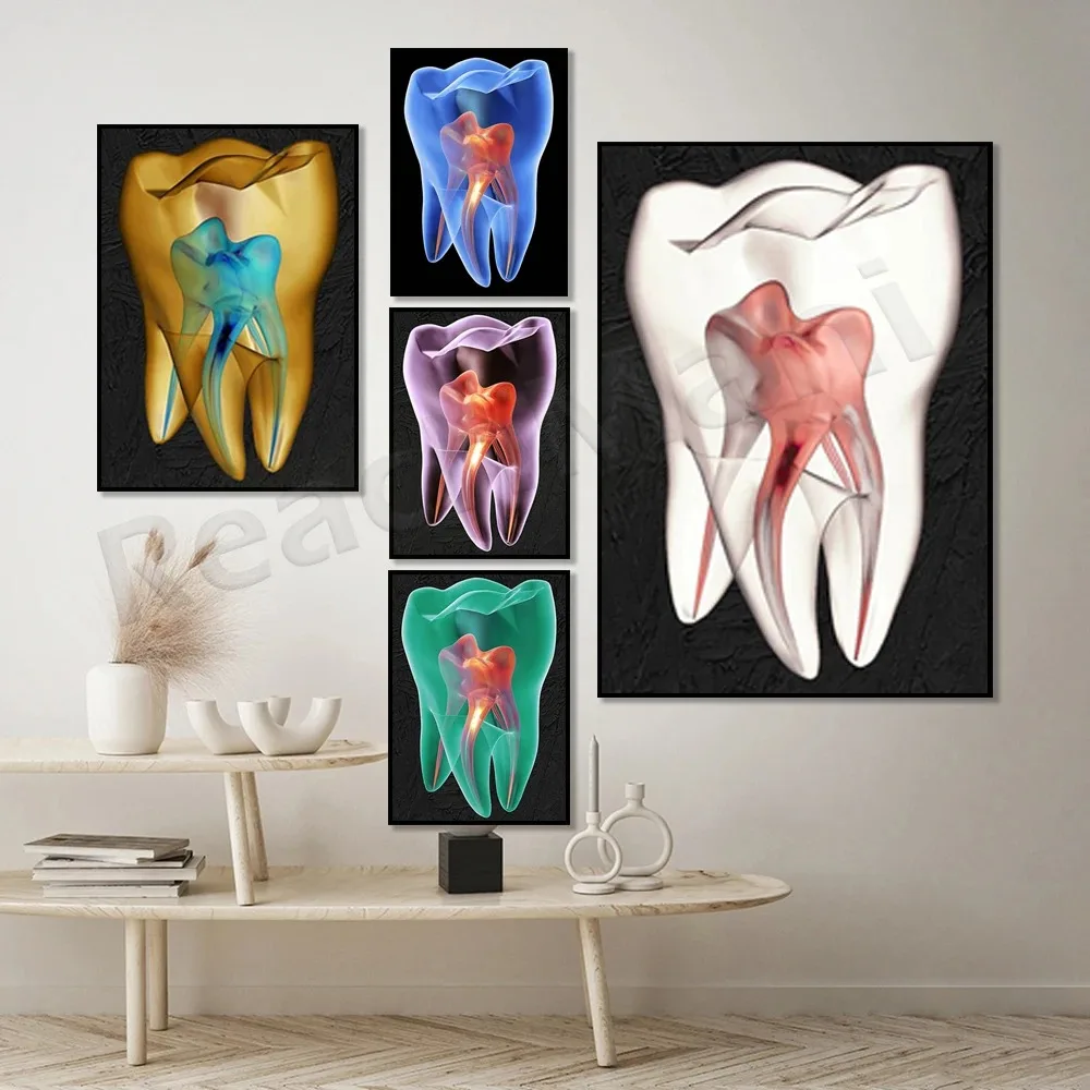 Teeth X-ray, Dental Art, Dentist Art, Dental Clinic Decoration Canvas Wall Art Poster Gift, Anatomy Oral Art Print