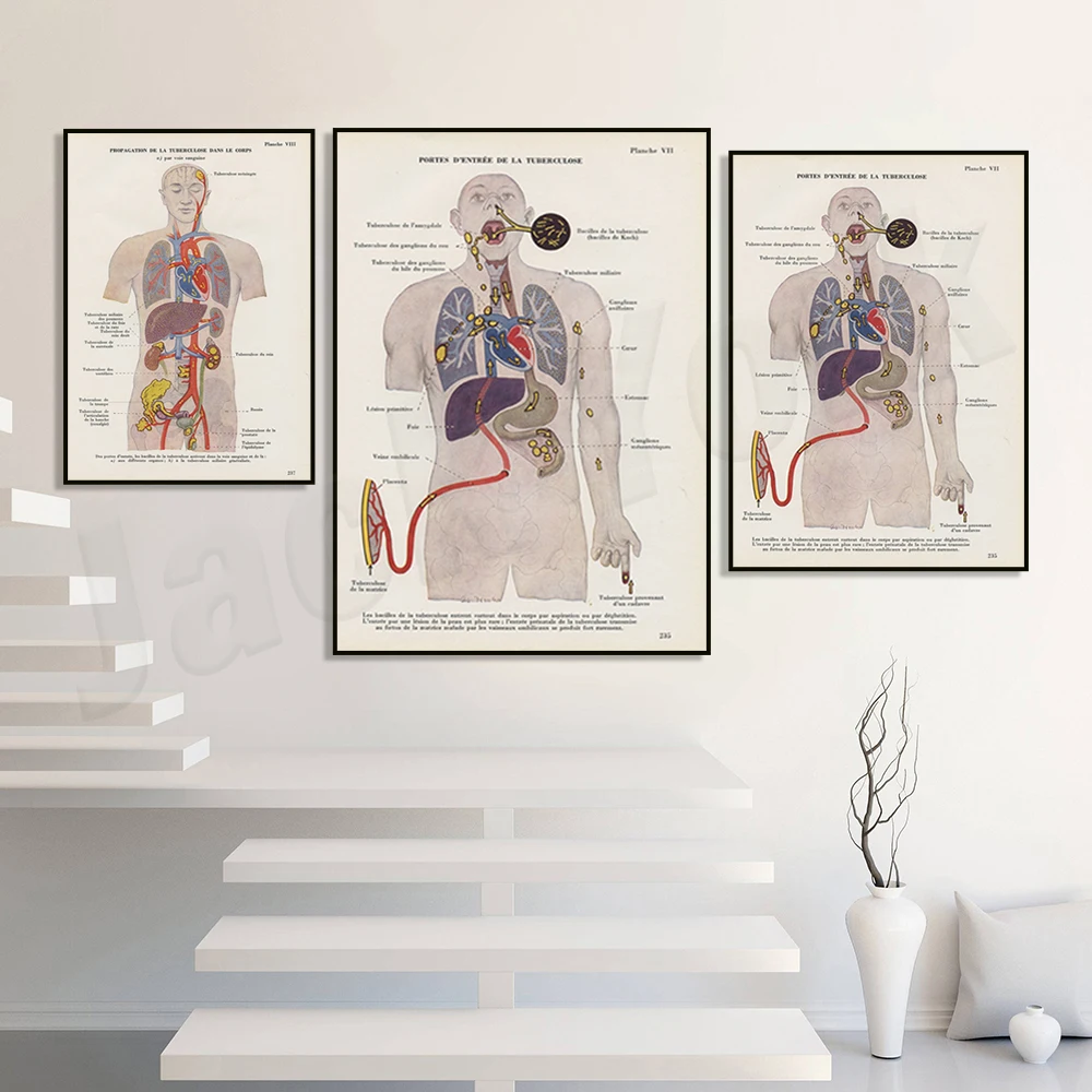 طباعة الرحل الطبية من عام 1952، ملصق تشريح الرحلان، هدية لقسم رئوي لتزيين مكتب الطبيب #4