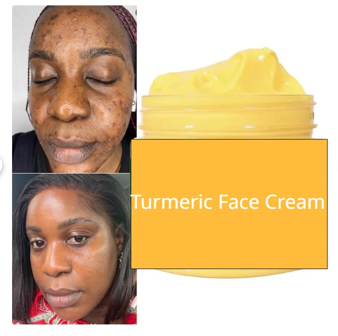 Turmeric Face Cream, Dark Spot Remover, Clearer, Smooth, Even Skin