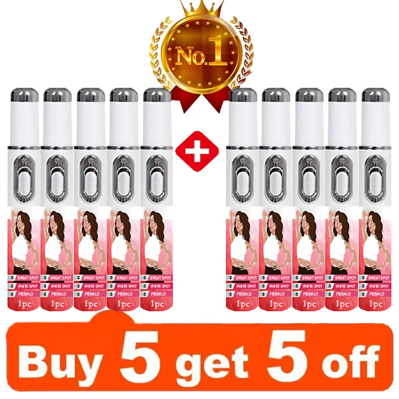 La penna laser migliora il vitiligine