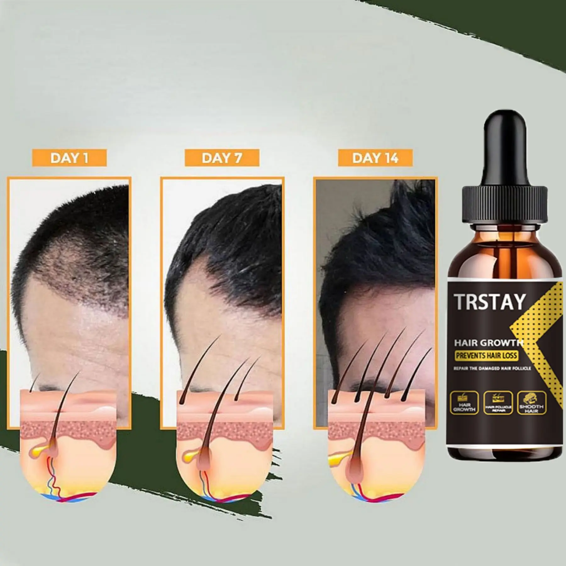 Hair Regrowth Essential Oils Essence for Man Woman