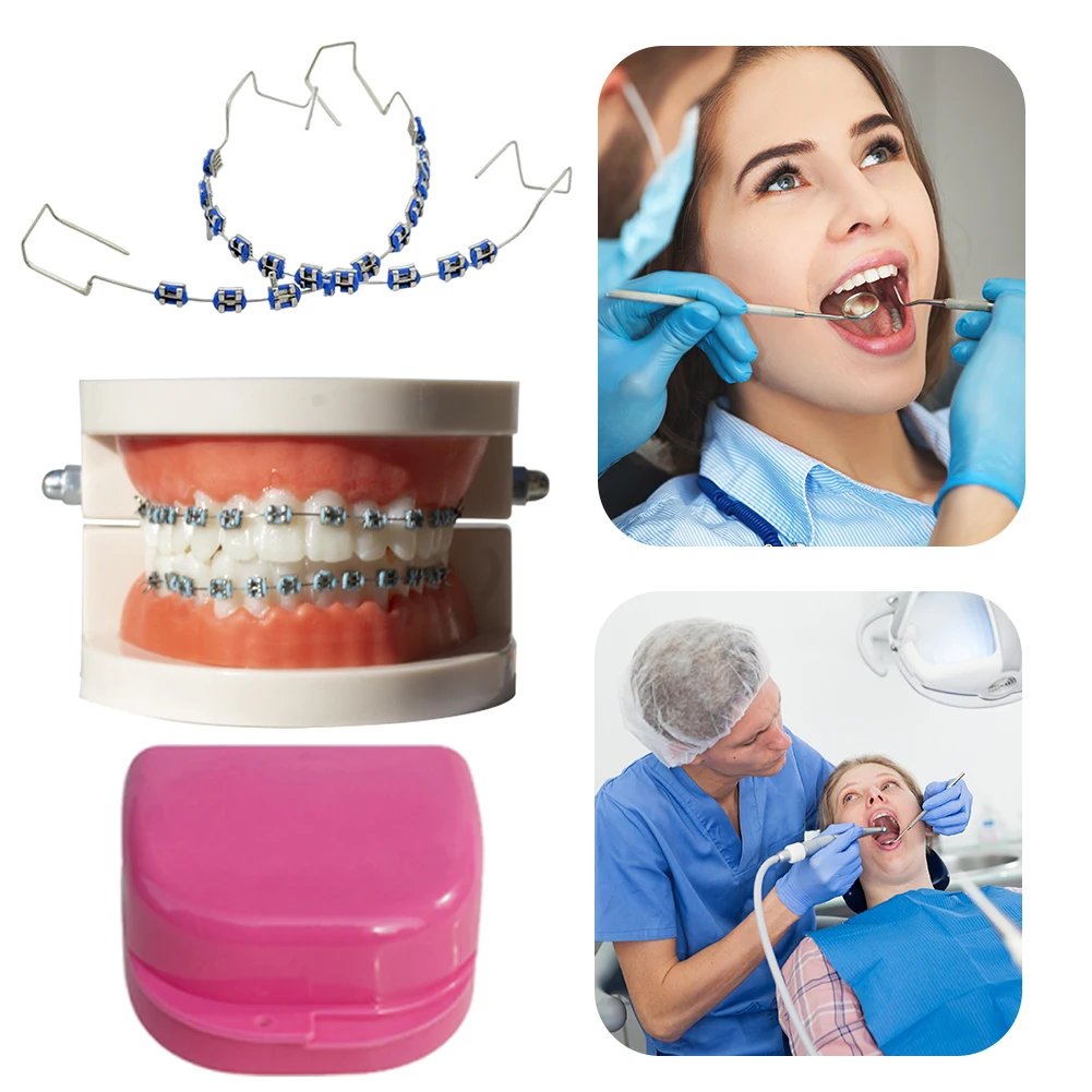 

2Pcs Dental Fake Braces with Box Temporary Tooth Decoration Colored Dental Decor Braces for Tooth Protect Metal Wires Bracket