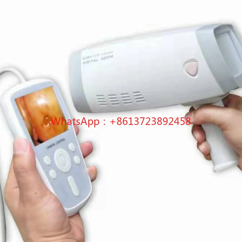 YD-220A Digital Handheld Direct-to-Screen Video Colposcopy mobile digital  Portable Digital  Vagina Video