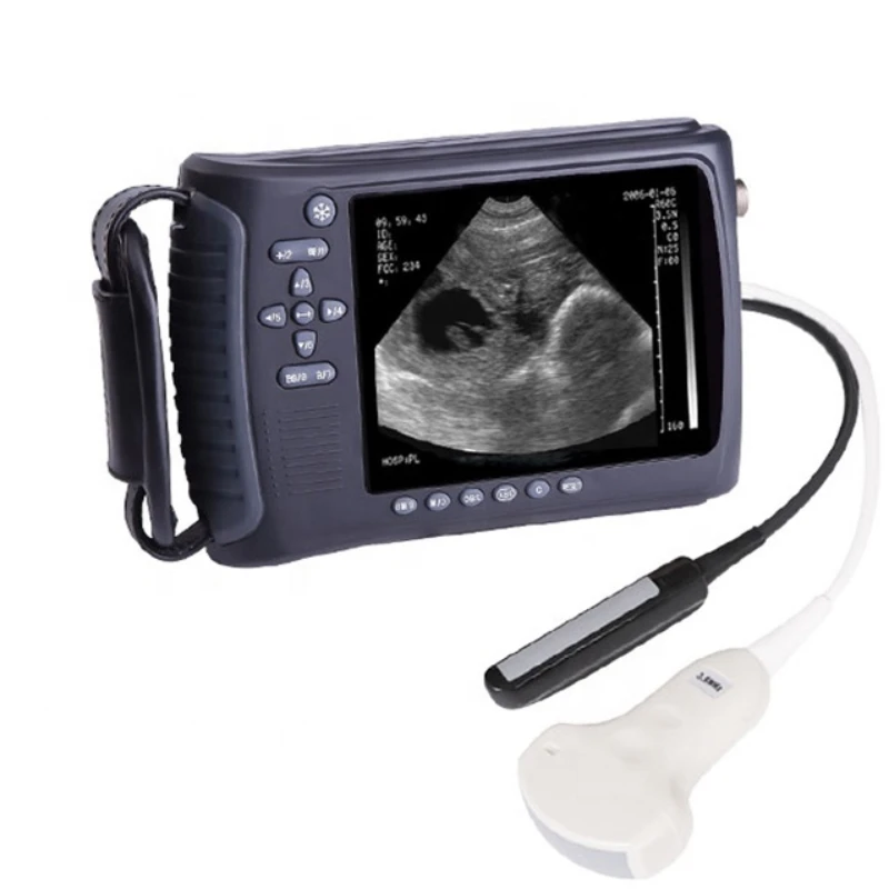 

Portable Veterinary Ultrasound Devices For Bovine Equine Swine With Rectal And Convex Probe