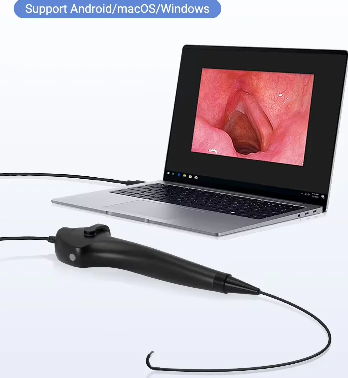 

ENT Nasal Scope Flexible Rhinolaryngoscope CMOS + LED Video USB Endoscope