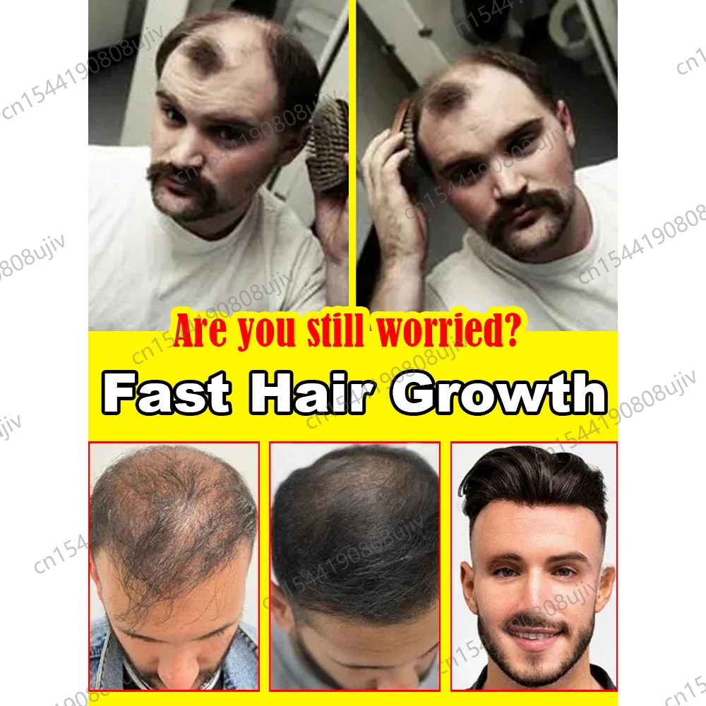 Hair Growth Oil Fast Effective Hair Growth Products For Men Women Hair Care Anti-Hair Loss Seborrheic Alopecia Alopecia Areata