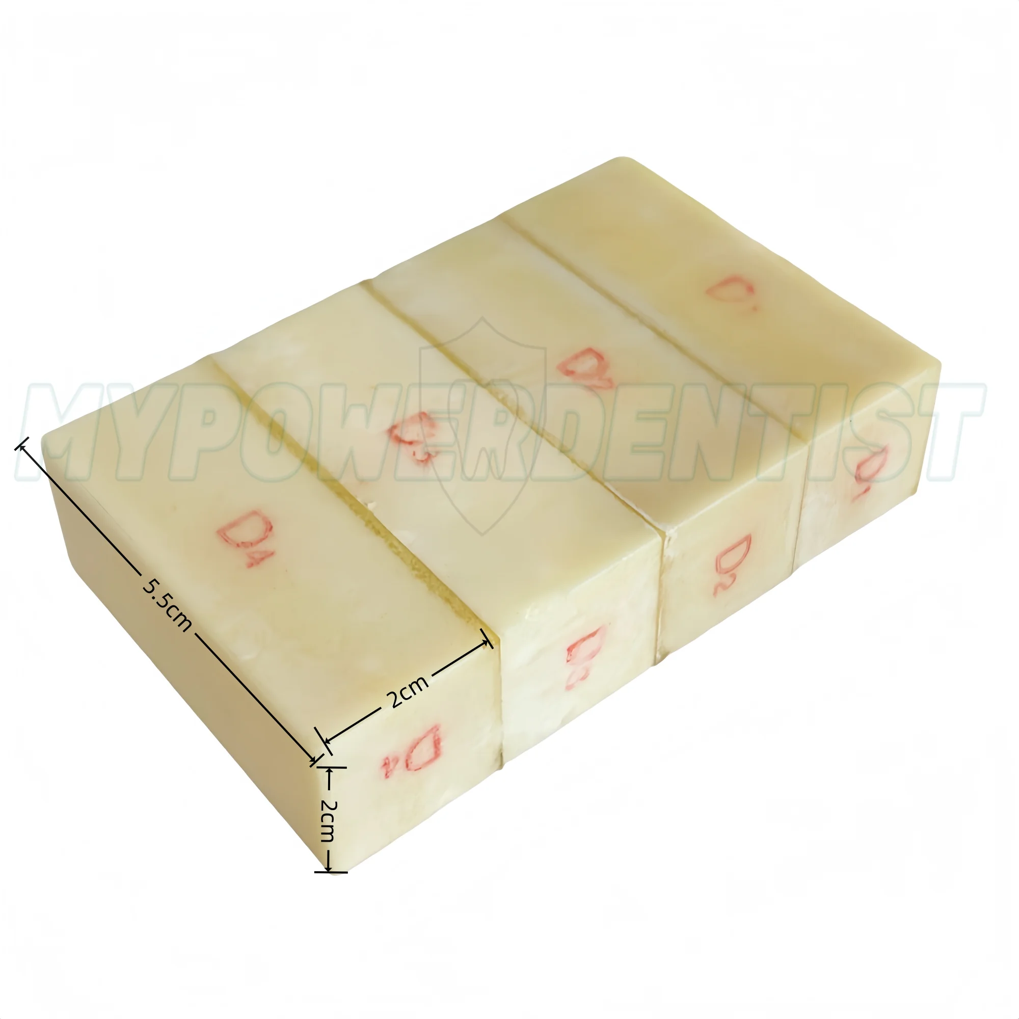 

Dental Alveolar Jaw Bone Replica Practice Study Model Implant Block Resin Dental Study Model