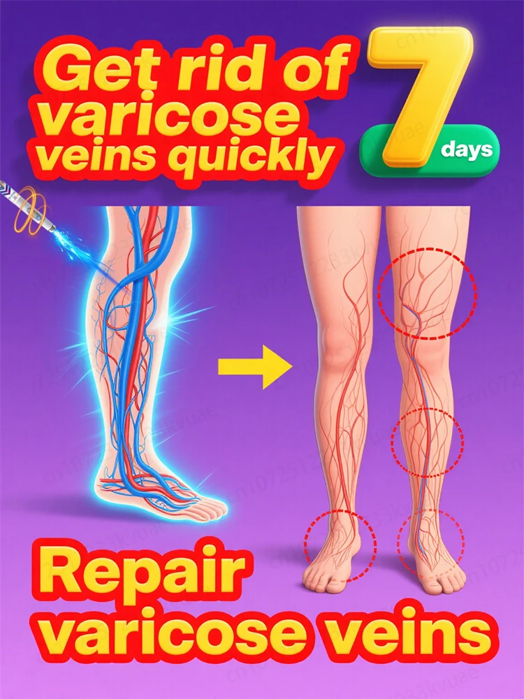 

Blue light varicose vein tool, more discounts on sets