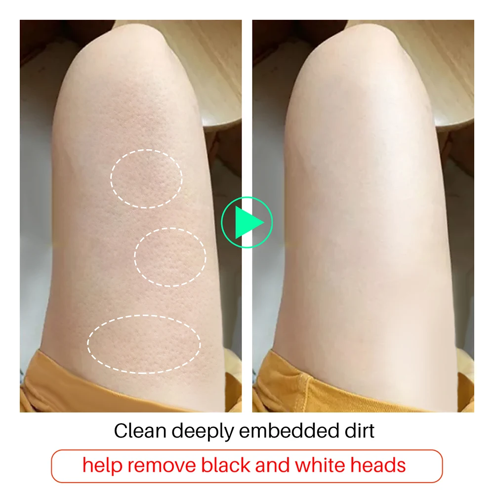 

New LANTHOME Glutathione Soap 100ml Handmade Soap Essential Oil Soap Kojic Acid Soap Cleaning Soap Reduce Dead Skin Blackheads