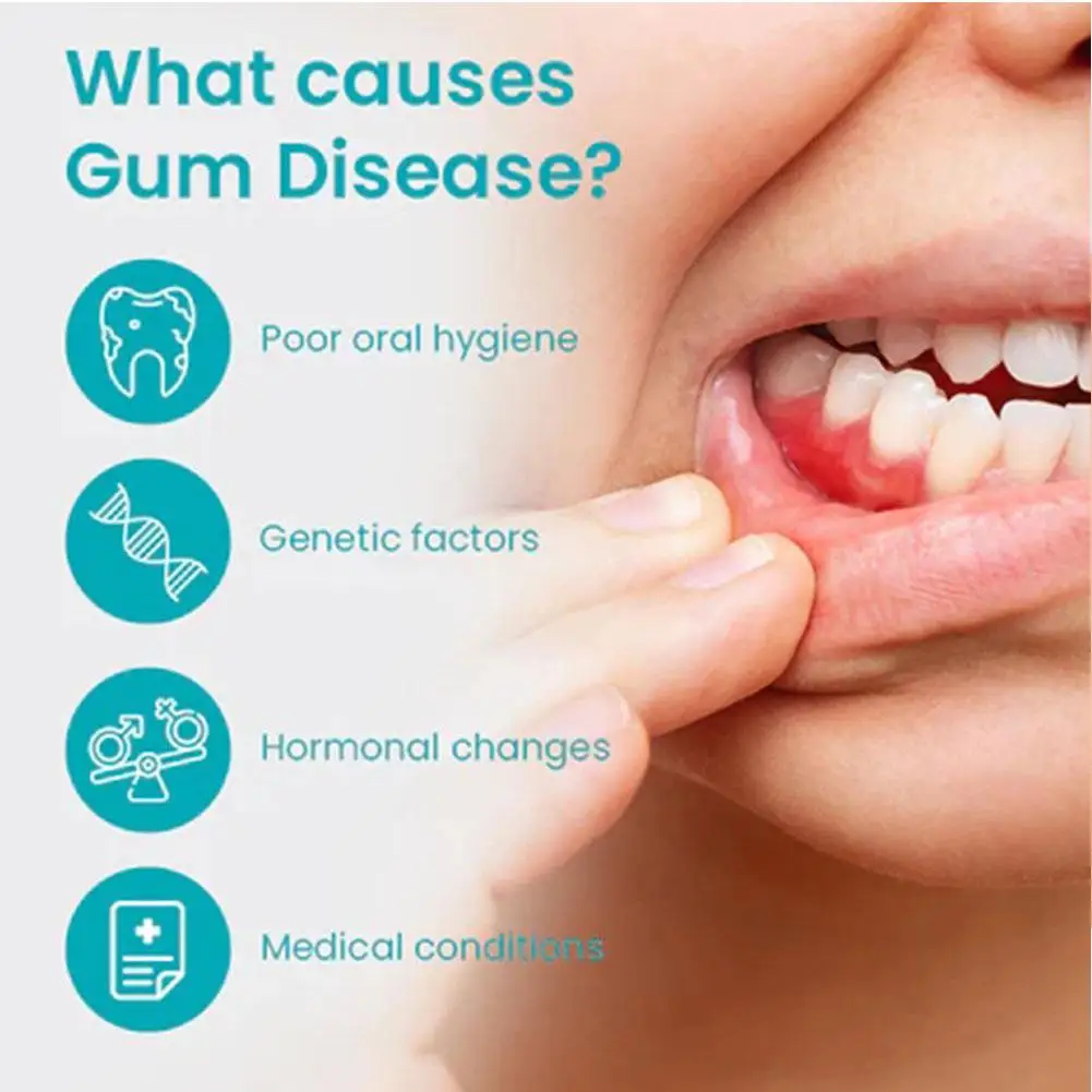 Ручка для отбеливания зубов, гель для лечения десен, эффективное безболезненное отбеливание зубов, отбеливание, уход за зубами, гелевая ручка для чистки зубов F3J8