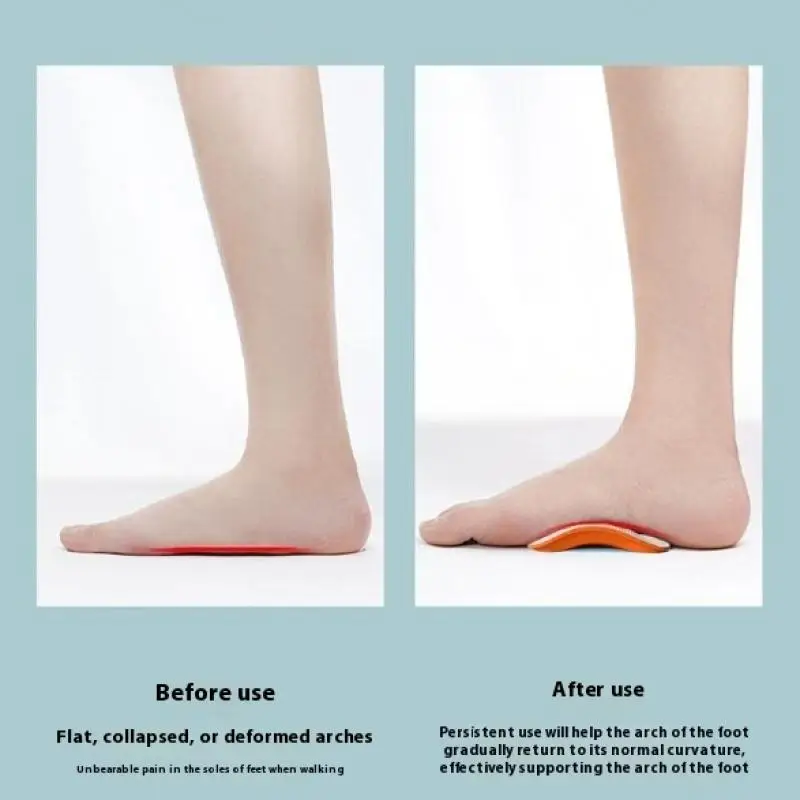 1 Pair Men Women Foot Valgus Varus Sports Insoles Shoe Inserts EVA Flat Feet Arch Support Orthopedic Pads For Shoes