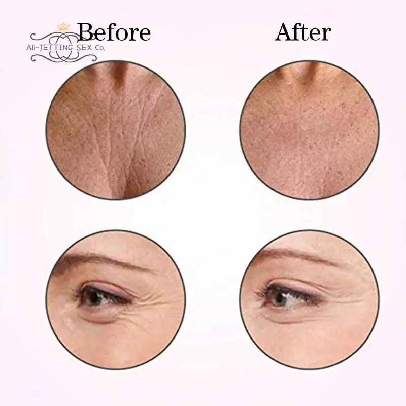 Silicone Anti-wrinkle Patch Skin Care Sticker Pad Suit Firming Wrinkle-removing Anti-wrinkle Beauty Patch For Chest Face Neck