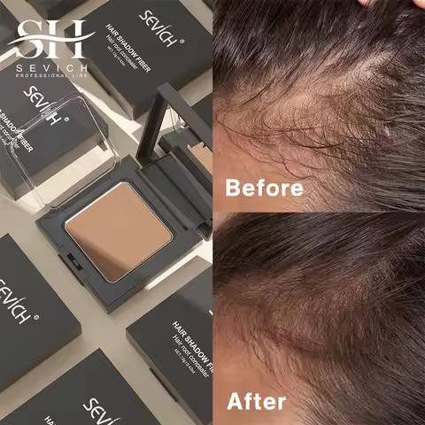 Sevich 5 Colors Concealer Hair Powder 12g Dark Brown Hair Fluffy Powder Instantly Cover Up HairLine Shadow Powder