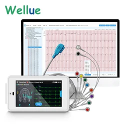 Viatom PC-ECG500 Pocket Ecg Monitor With Glasgow Analysis 6000mAh For 24 Hours Recording 6 Channel 12 Lead Ecg Machine