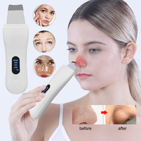 Facial Ultrasonic Spatula Skin Care Blackhead Remover Black Dot Face Cleaning Ultrasonic Skin Scrubber Deep Face Spatula Peeling
