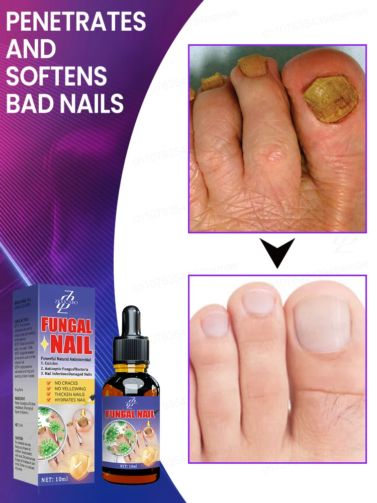 ᴿᵉᵐᵒᶜ̧ᵃ̃ᵒ ᵖʳᵒᶠⁱˢˢⁱᵒⁿᵃˡ ᵈᵒ ᶠᵘⁿᵍᵒ ᵈᵒ ᵖʳᵉᵍᵒ