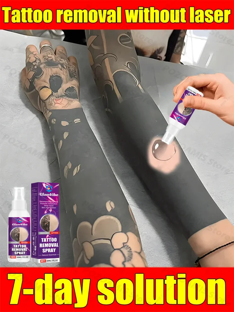 

Fast Tattoo Removal Cream Permanently Lightens Tattoo Removal