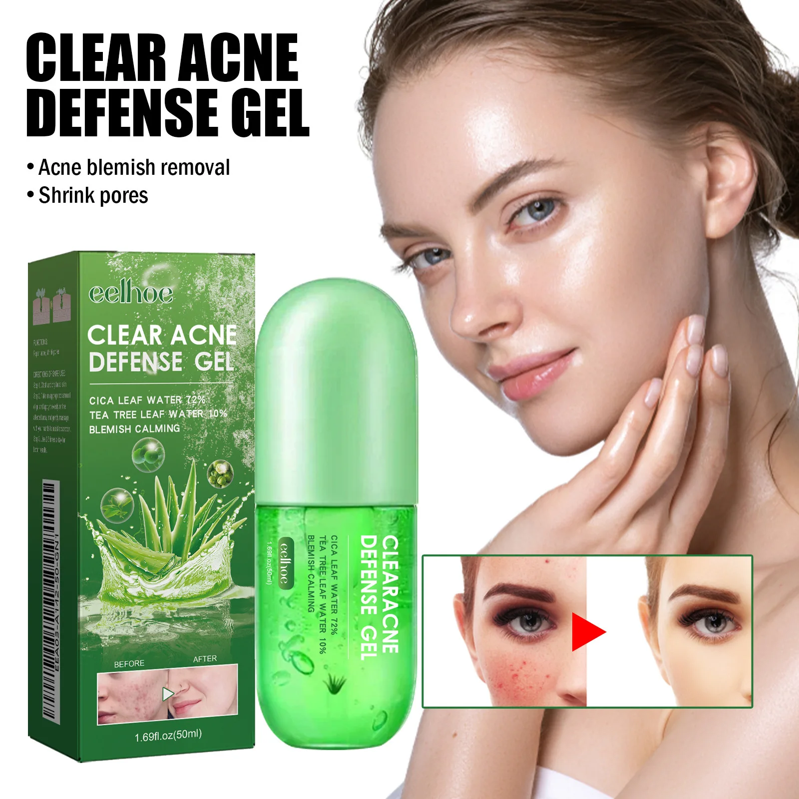 Aloe Vera Riparazione Gel per la cura Acido ialuronico Schiarisce le cicatrici dell'acne Acne Bocca chiusa Miglioramento Acne Pelle Crema idratante per il viso