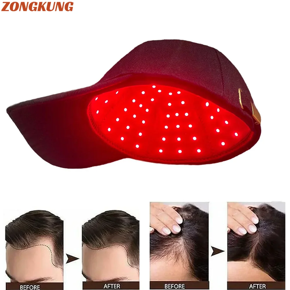 Terapia de cabello infrarroja con luz roja de 660nm y 850nm, gorro para el crecimiento del cabello, antipérdida de cabello, relajación, cuidado del cuero cabelludo, sombrero antipelo