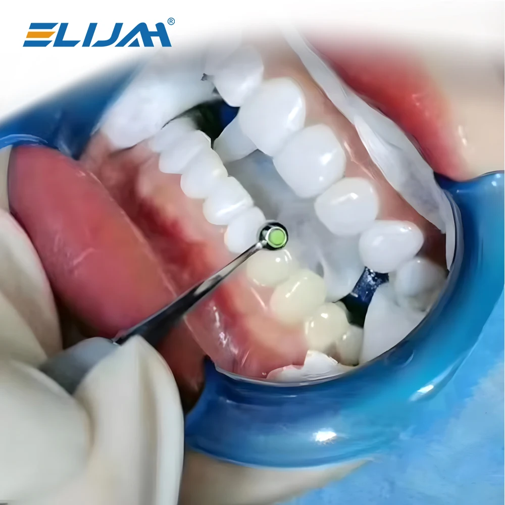 Zestaw do napełniania żywicy dentystycznej Narzędzia do formowania Kompozytowy uchwyt do lekkiego utwardzania Szybka podkładka piankowa Uchwyt Trymer Szpatułka — zdjęcie 6