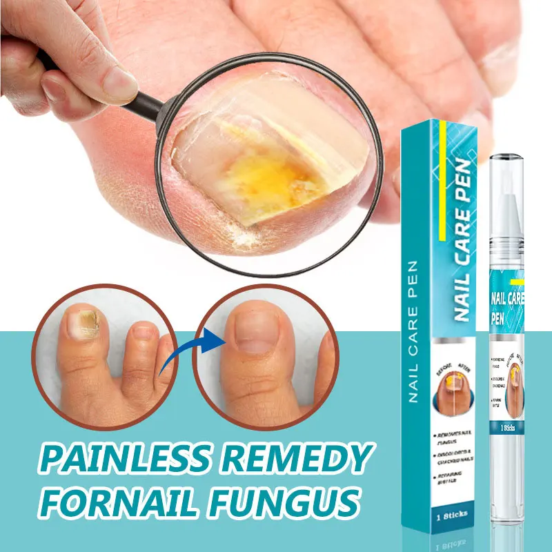 Effective Fungal Nail Treatment Serum Hand Foot Nail Repair Care Toe Sterilization Anti-Infective Gentle And Non-irritating 3ml