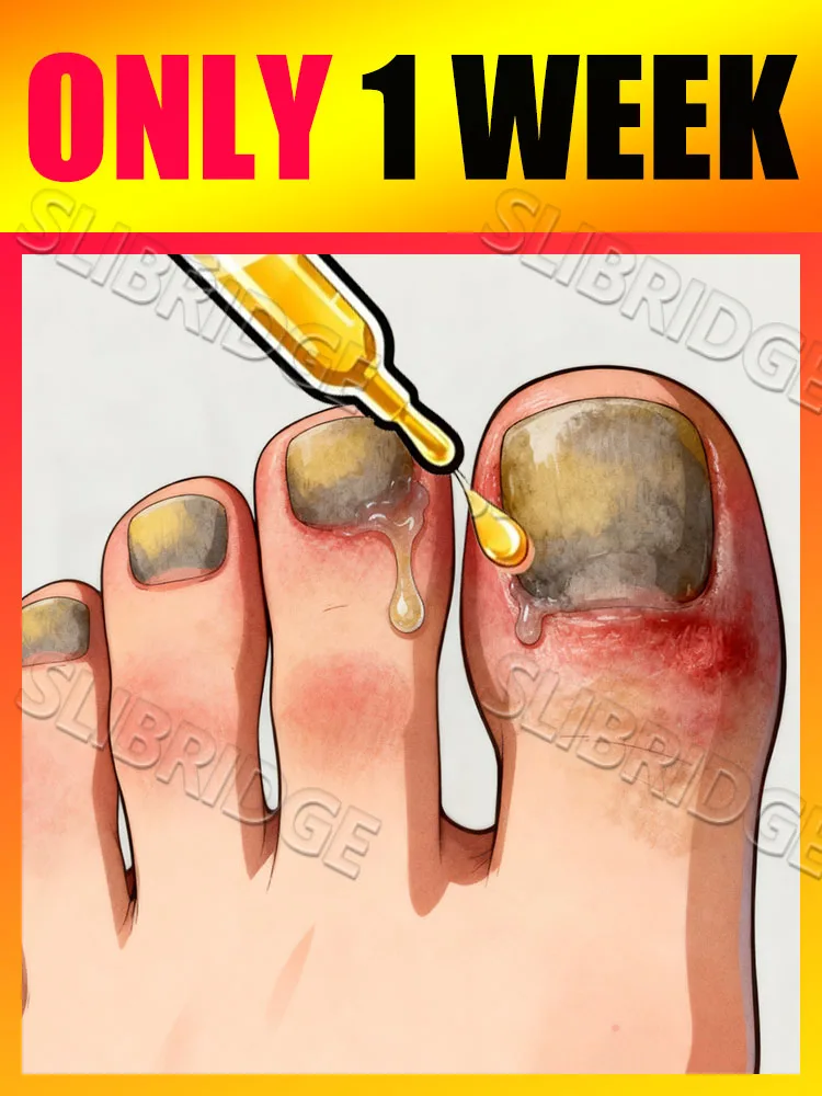 تم بيع فن الأظافر من الجيل الثاني لعام 2025 لجوهر إصلاح فطار الأظافر خلال 7 أيام