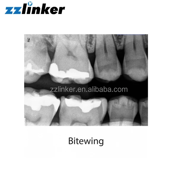 LK-C64 RVG 5200 X Ray Sensor Den-tal Di-gital X Ray Sensor