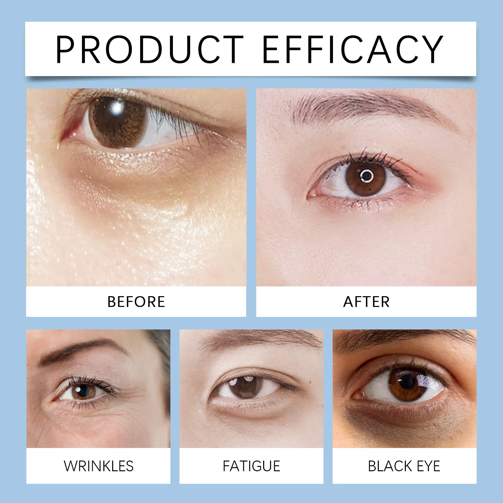 5-IN-1 Instant Eye Lift&Firming Cream,Immediate Firming&Tightening,Smooths Crow’s Feet&Deep Wrinkles,Diminishes Under Eye Puffiness, Eliminate Puffiness&Dark Circles,Collagen Boosting&Elasticity,Antioxidant Shield,Deep Hydration&For All Skin Types,Vegan