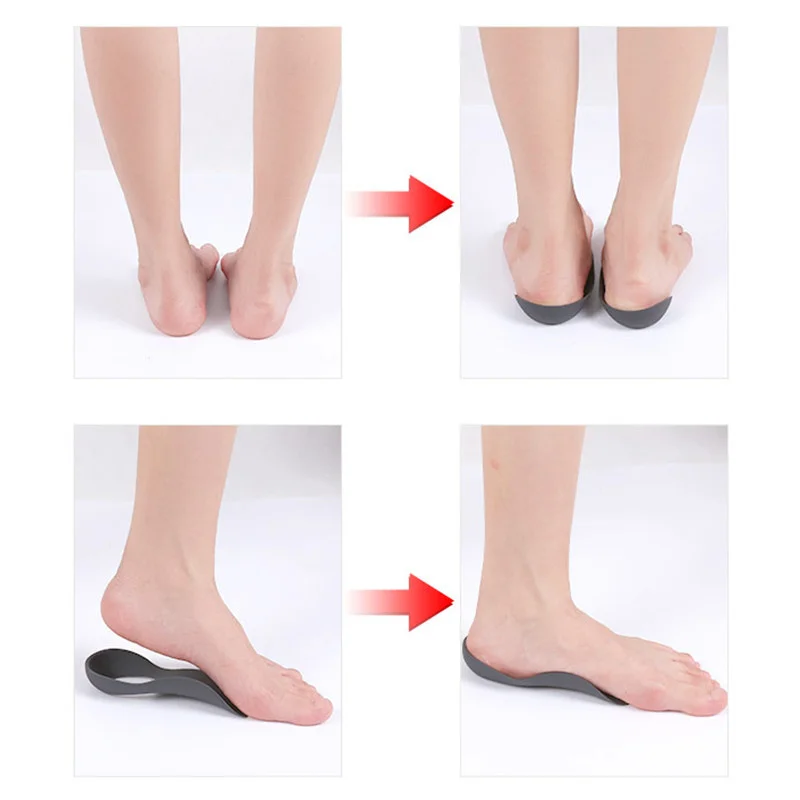 Sol dalam Orthotic, untuk XO berbentuk kaki korektor lengkungan dukungan Plantar Fasciitis sepatu ortopedi sol untuk wanita pria kaki datar