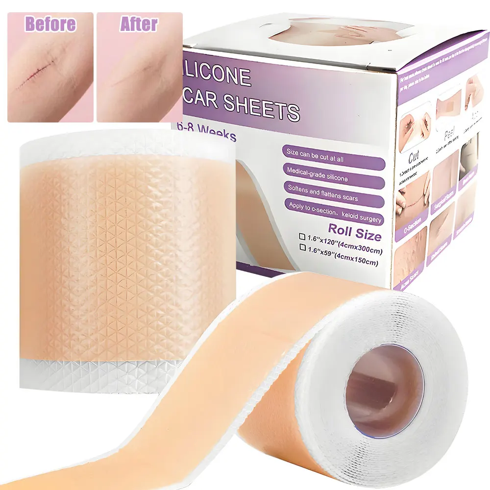 

1 Roll Silicone Scar Patch Sheets 4x150cm/4x300cm Self-Adhesive Scar Cover Tape Reusable and Effective Skin Care Removal Strips