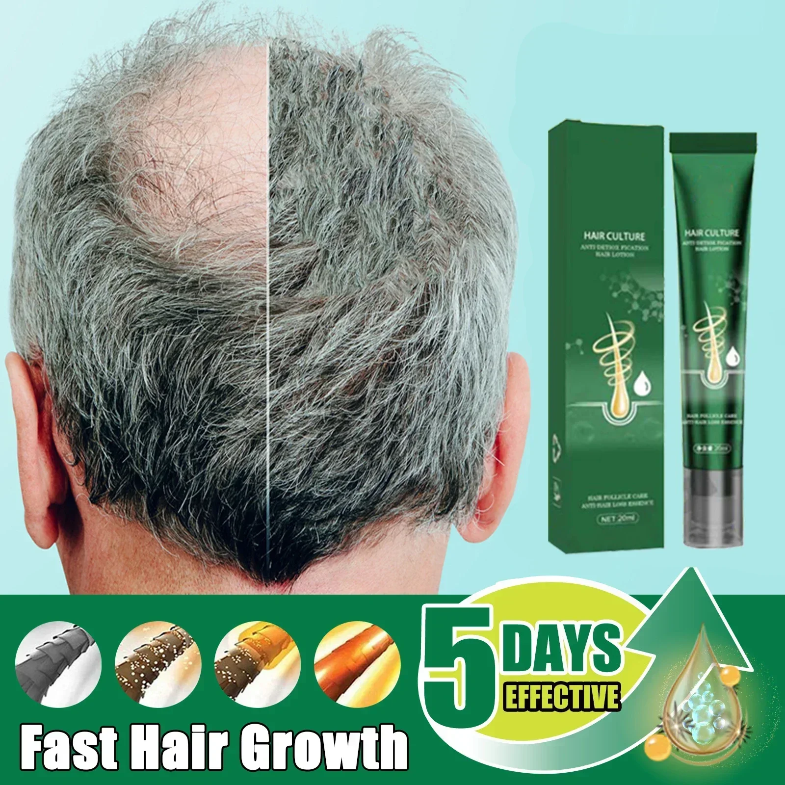 Hot sales Hair Loss Scalp Treatment Serum Beauty Health Products Fast Hair Growth for Men Women Ginger Oil Care 2024