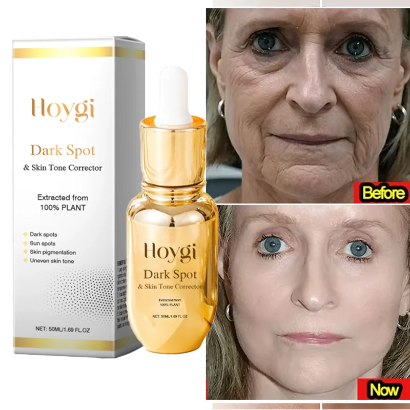 

Retinol Anti-Aging Essence Improve Fade Fine Lines Repair Firming Brightening Moisturizing Tightening Korean Skincare Products