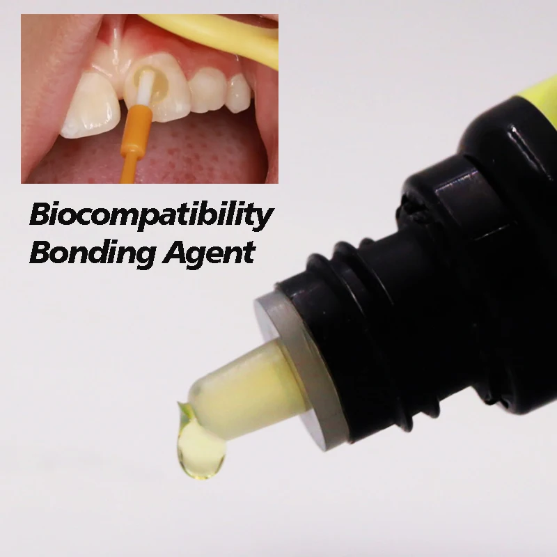 Dental Innovations Applications Tooth Curing Light 5ML Bonding Agent Techniques for Enhanced Clinical Material Strong Adhesion