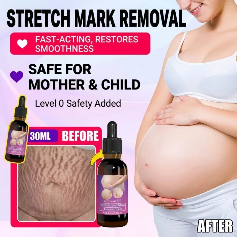 Advanced Stretch Mark Removal and Body Firming Oil