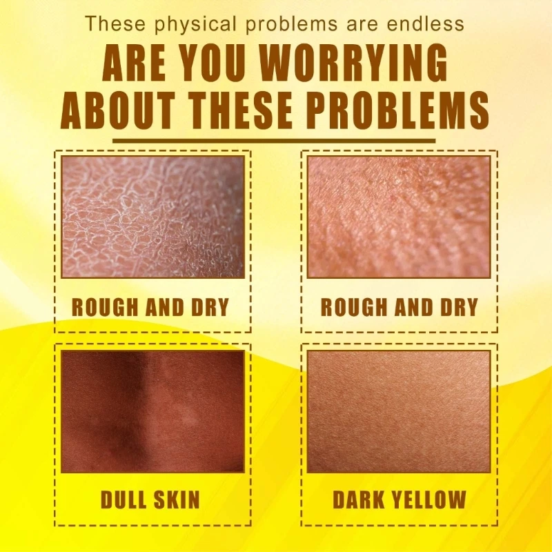 Face Body Peeling Oil Exfoliator Peel Off Calluses Dead Skin แคลลัส Remover สำหรับ Baby Soft Smooth Skin 1fl-oz