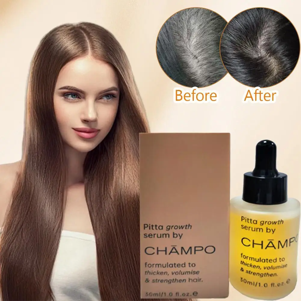 

30ML Hair Growth Essence Nourish Hair, Thicken, Plump, And Strengthen Hair