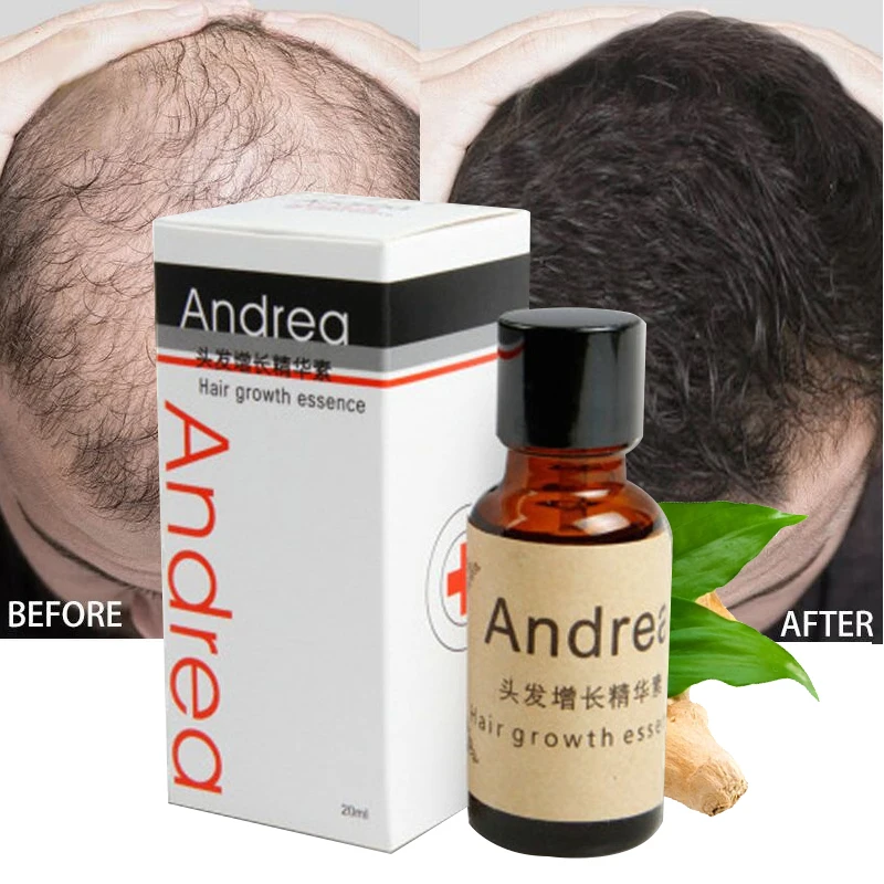 2/5/10Pcs Andrea Hair Growth Serum Oil Herbal Keratin Fast Hair Growth Alopecia Loss Liquid Ginger Sunburst Yuda Pilatory Oil