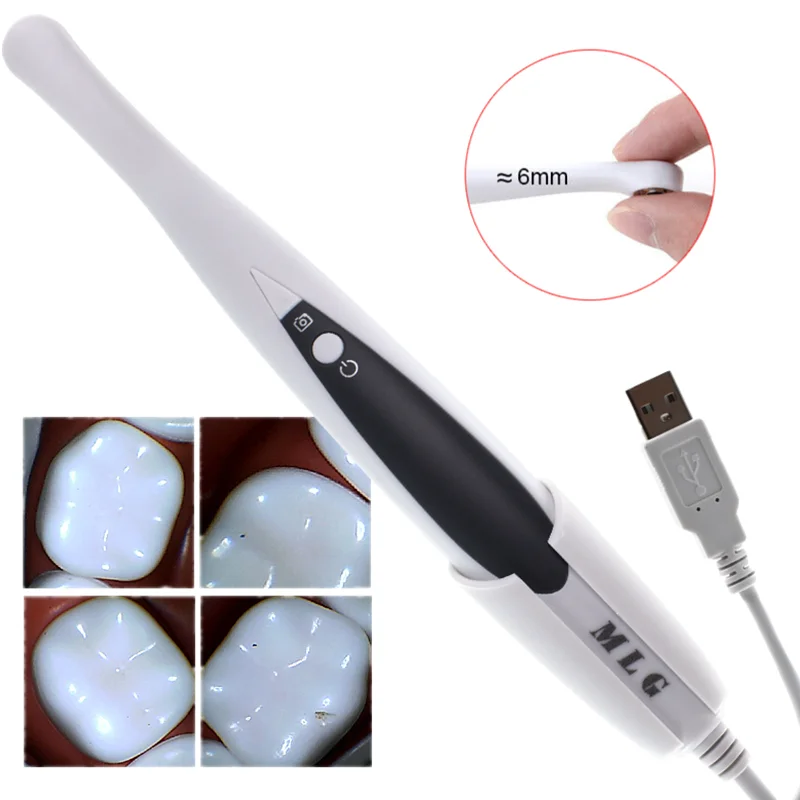 

Supermini Lens 6mm USB CMOS Intraoral Camera HD 8.0 Mega Pixels 6 White LED Dentistry Tool Teeth Endoscope