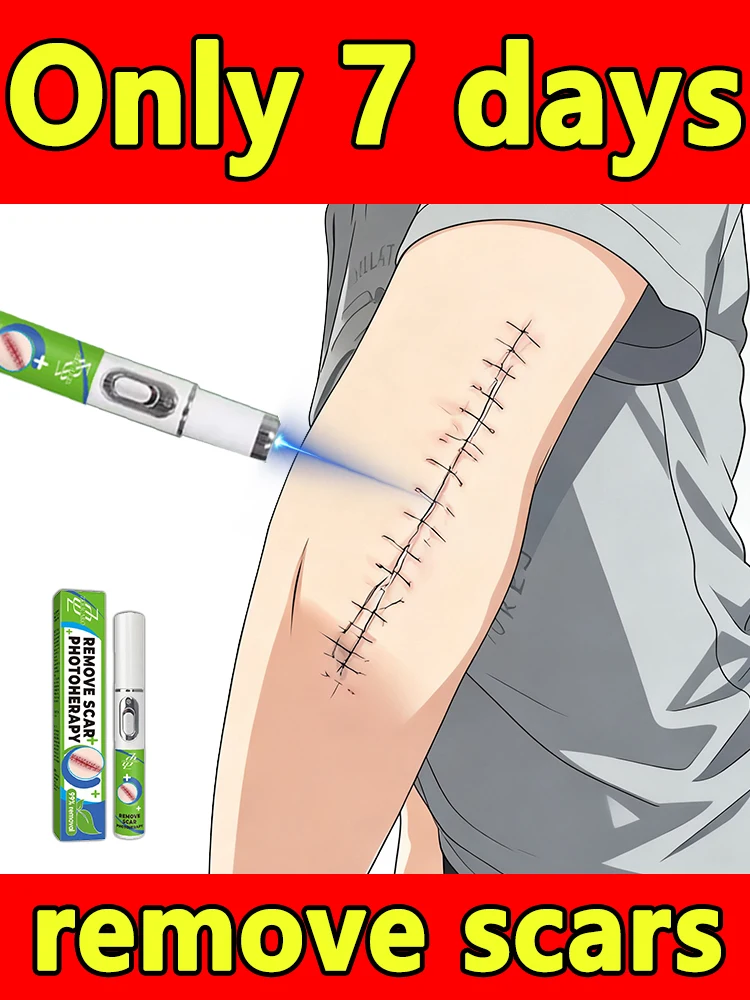 Aᴛ-Hᴏᴍᴇ Sᴄᴀʀ Sᴍᴏᴏᴛʜɪɴɢ Pᴇɴ - Fᴀᴅᴇs Sᴜʀɢɪᴄᴀʟ Sᴄᴀʀs, Iɴᴊᴜʀʏ Mᴀʀᴋs & Bʟᴇᴍɪsʜ Sᴄᴀʀs, Eᴀsʏ ᴛᴏ Oᴘᴇʀᴀᴛᴇ Aɴʏᴛɪᴍᴇ