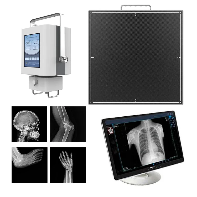 Careray Medical Mammography 14 X 17 Rayos X Detector De Panel Plano X Ray Machine Price