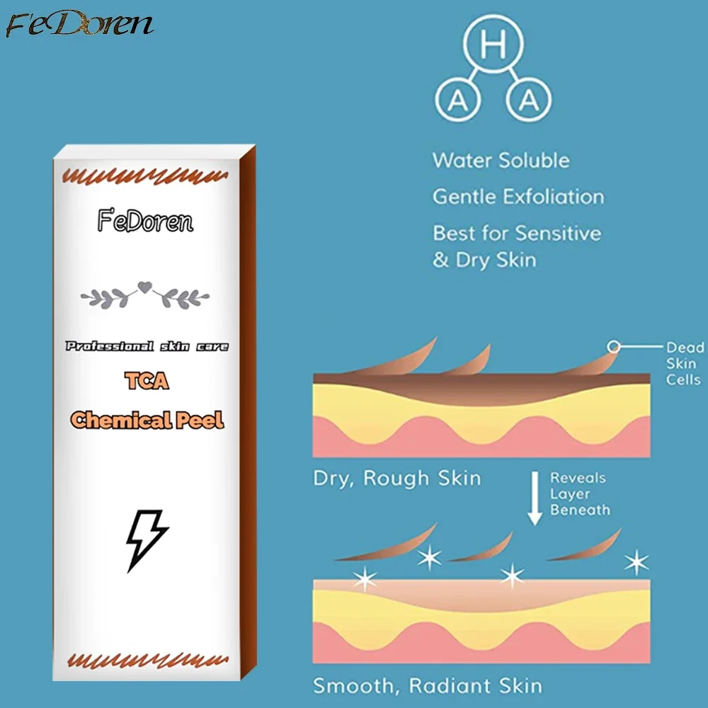 30ml Glycolic Acid TCA Chemical Peel 70%/20% Peeling Acid skin remove skin Superforce Peeling Skin care