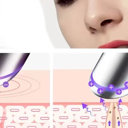 Electric IPL Vibration Eye Massager Anti Dark Circle Blue Light Anti Wrinkle Eye Massage Pen Hot Compress Eye Beauty Care Device