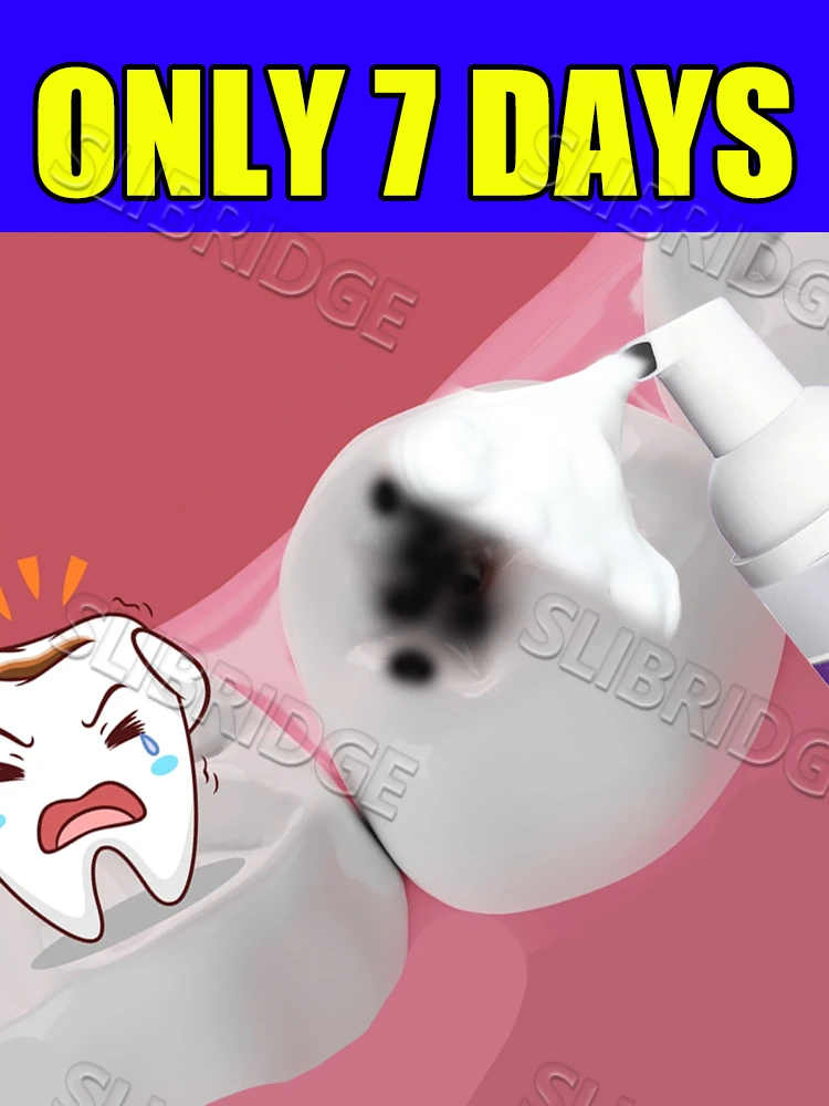 2025 Il nuovo aggiornamento Mousse risolve vari problemi Strumenti per la cura intraorale