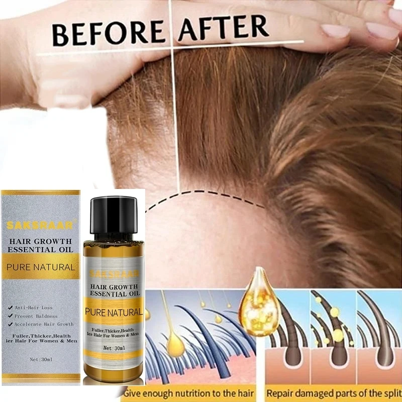 Aceite esencial para el crecimiento del cabello, esencia Original y auténtica, líquido para la pérdida de cabello 100%, suero de belleza denso para