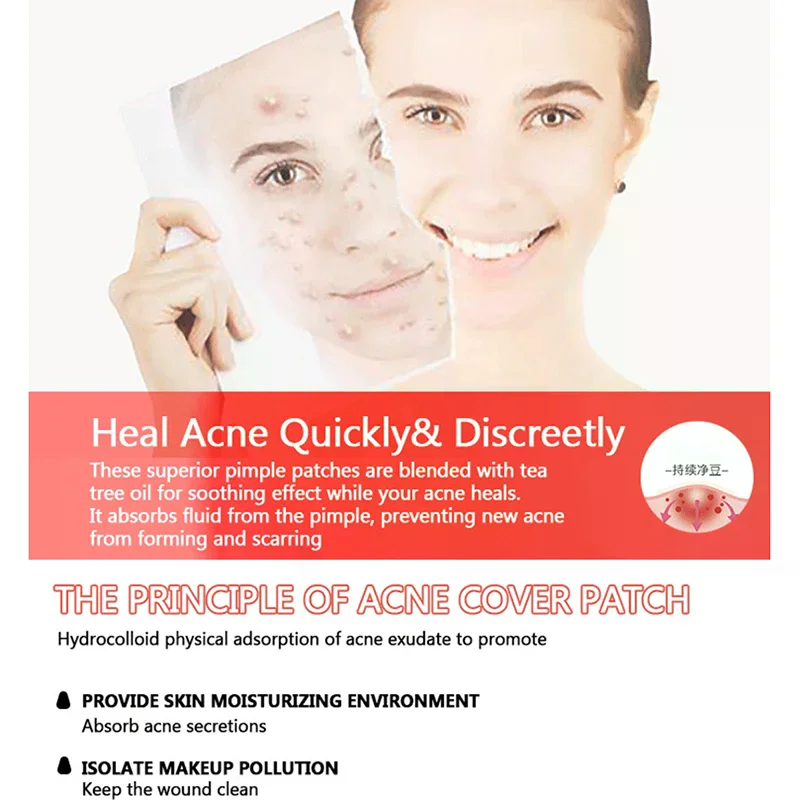 200 pz/set Colore Misto Del Fumetto Adesivi Per L'acne A Forma di Stella A Forma di Cuore Adesivi Circolari Cura Della Pelle E Strumenti di Trucco Viso