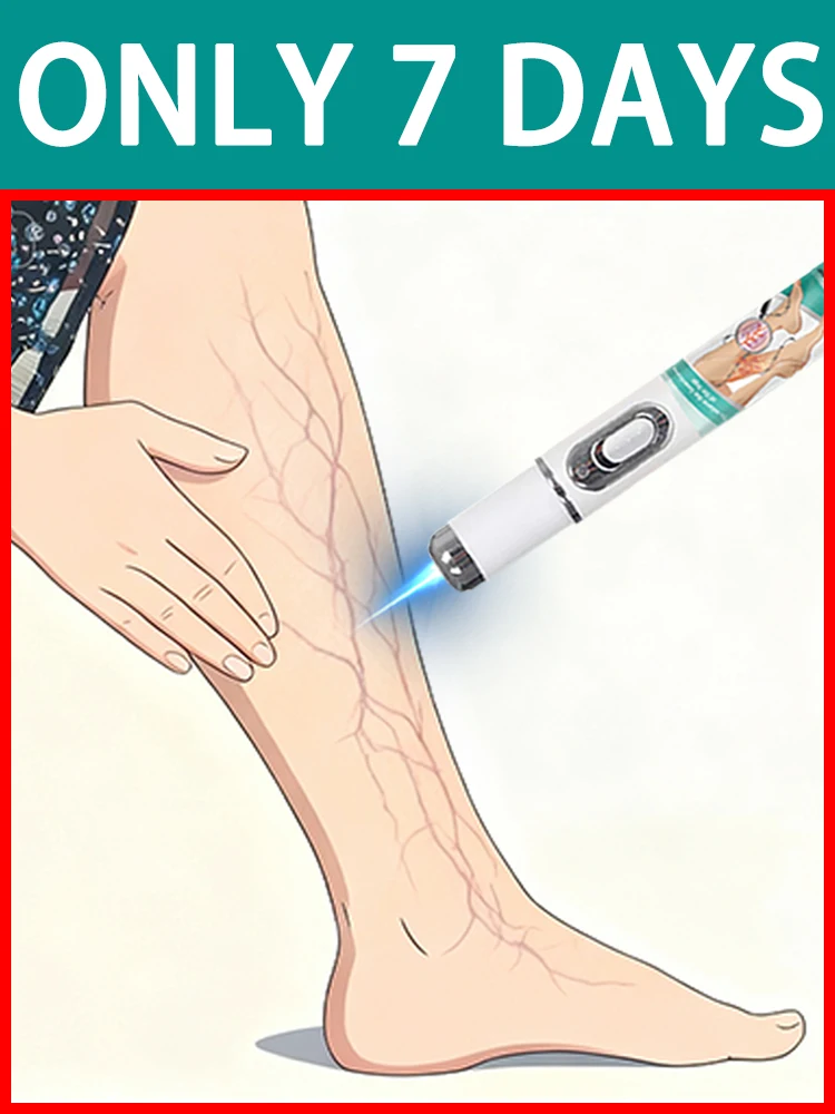 

2nd ᵍᵉⁿᵉʳᵃᵗⁱᵒⁿ ᵘᵖᵍʳᵃᵈᵉᵈ vᵉⁱⁿˢ ⸴ ʳᵉpᵃⁱʳ vᵉⁱⁿˢ ʳᵒoᵗ ⸴ ᑫᵘⁱᶜᵏˡʸ